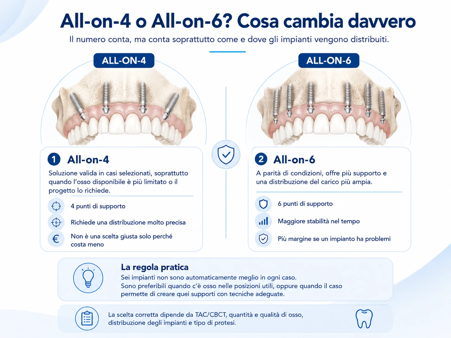 Infografica comparativa All-on-4 e All-on-6 con differenze nel numero e nella distribuzione degli impianti