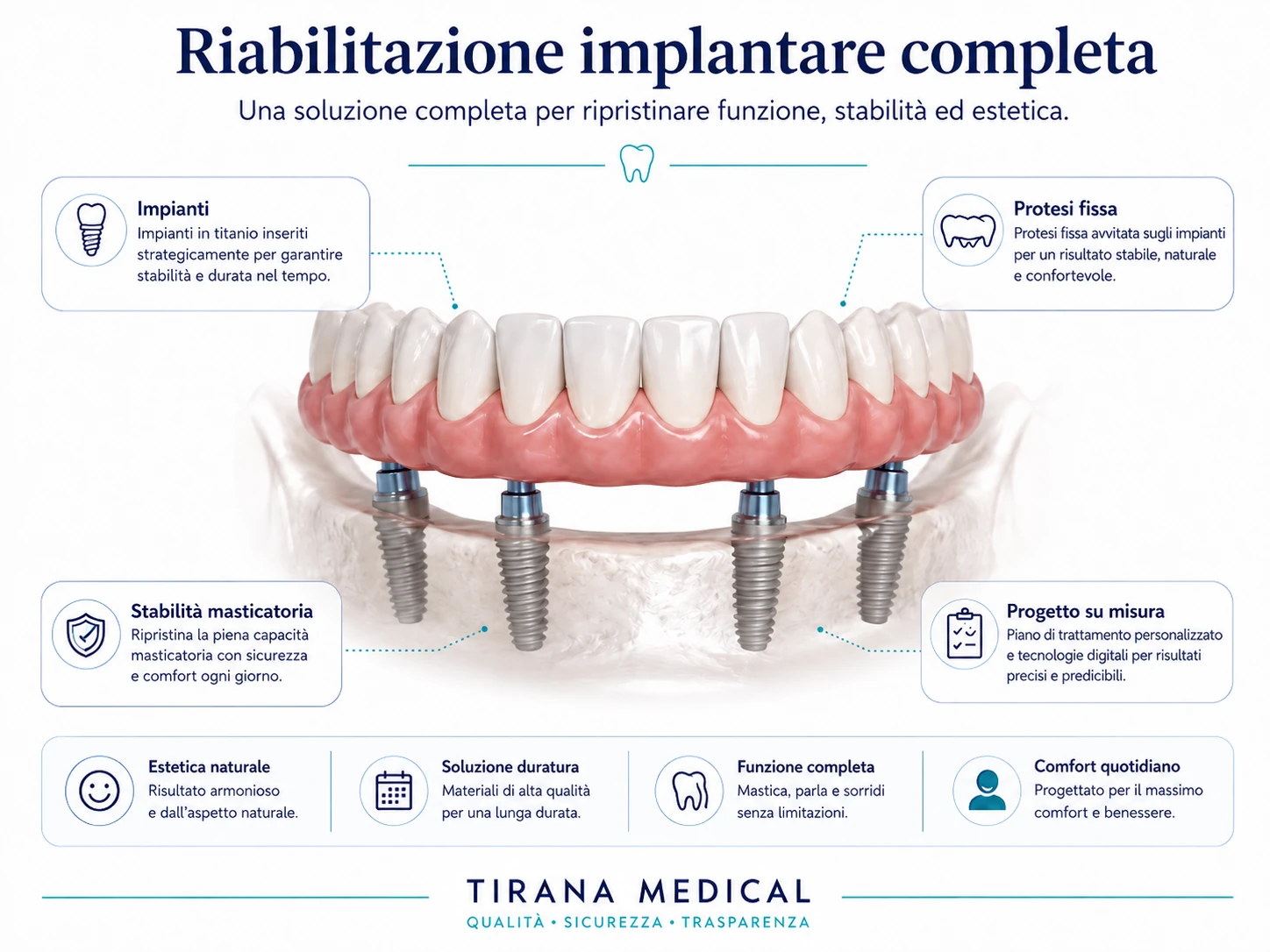Schema di una riabilitazione implantare completa con protesi fissa sostenuta da impianti
