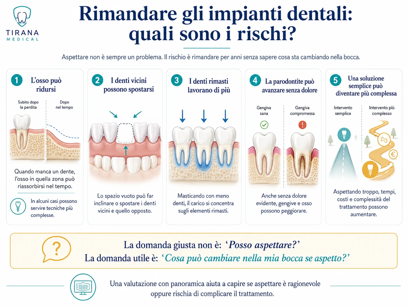 Infografica sui principali cambiamenti che possono verificarsi rimandando a lungo una riabilitazione implantare: riduzione dell’osso, spostamento dei denti, maggiore carico sui denti rimasti e progressione della parodontite