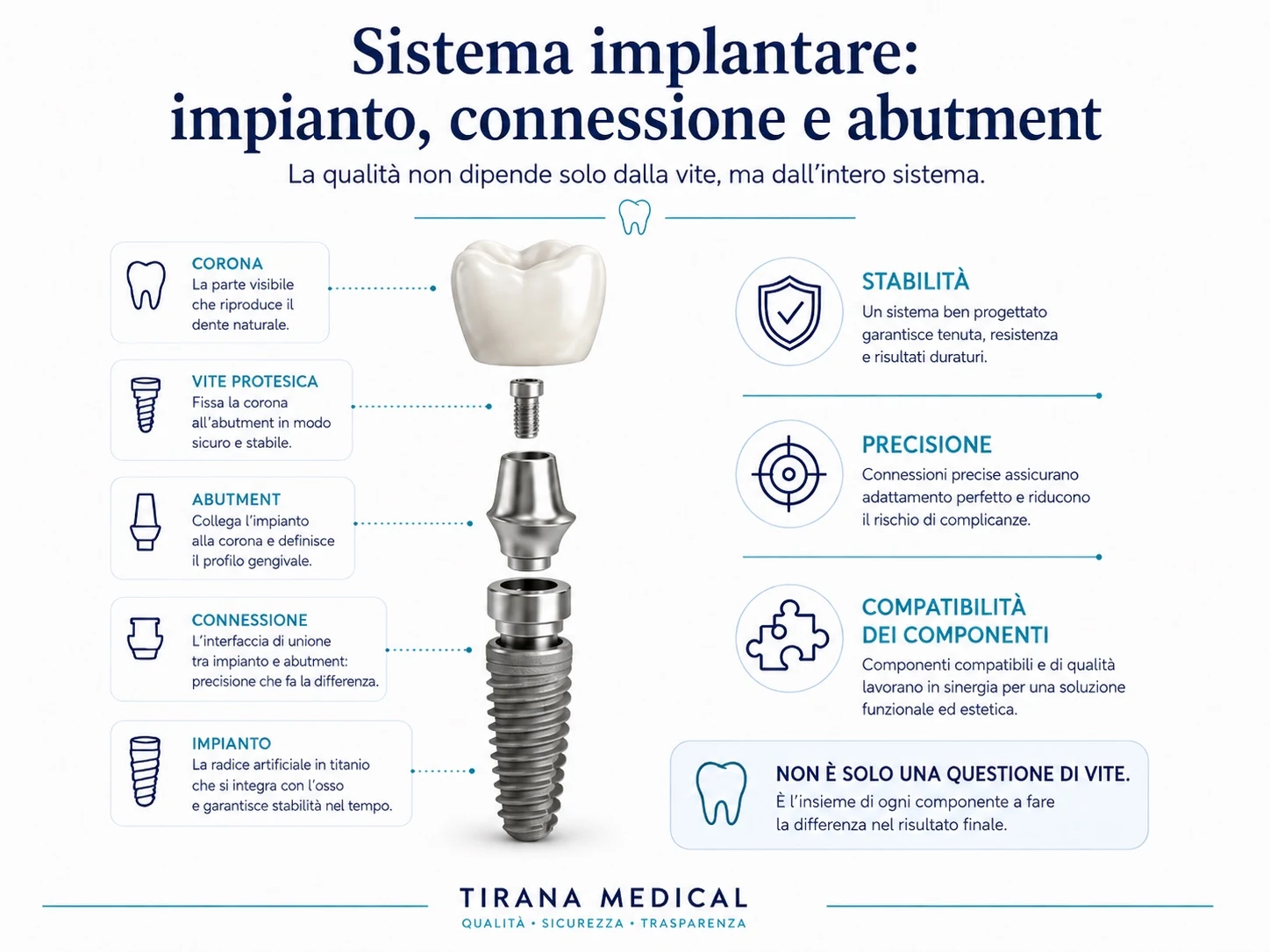 Sistema implantare: impianto, connessione, abutment e corona