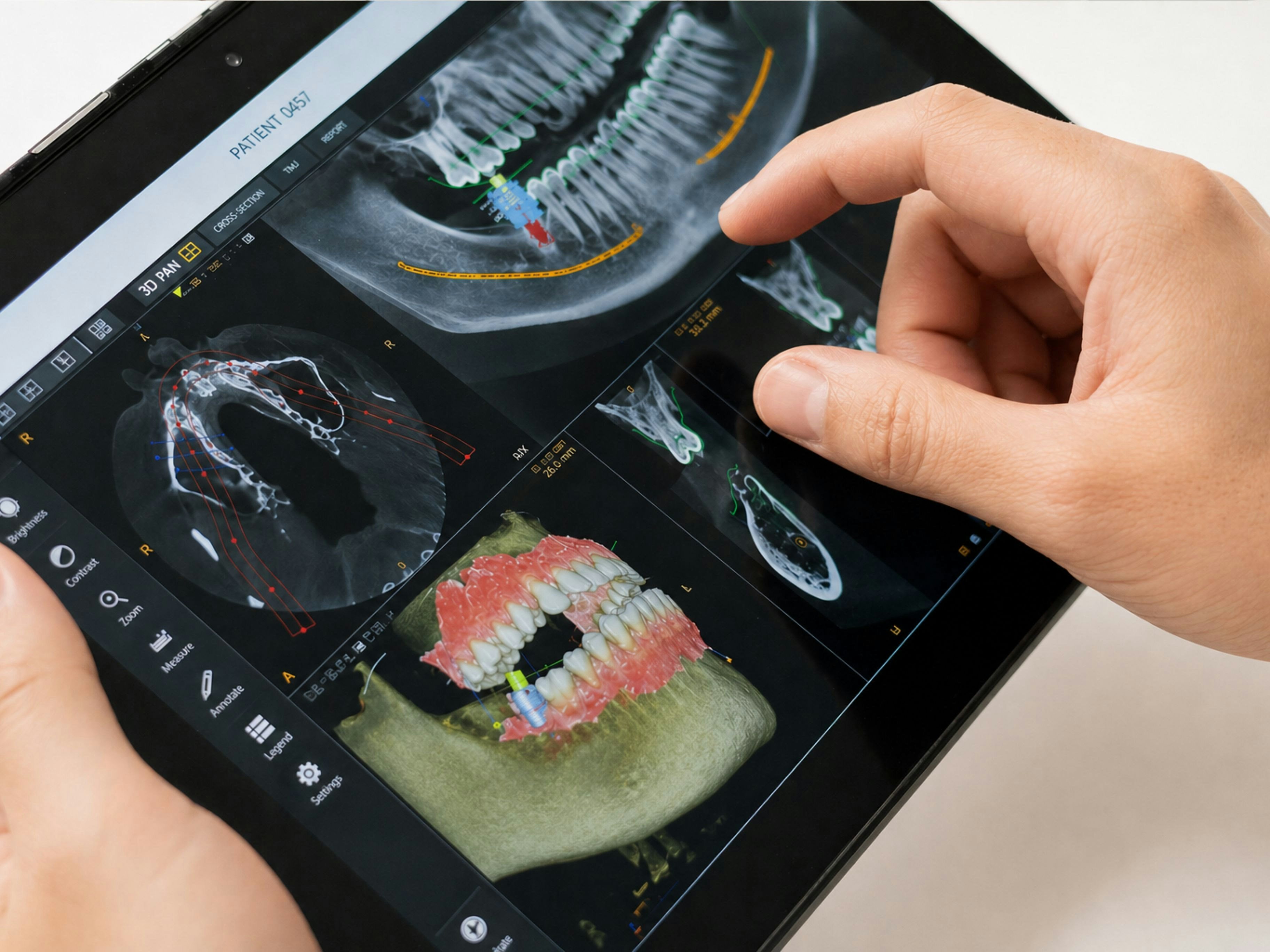 Digital diagnostic assessment in a dental clinic in Tirana