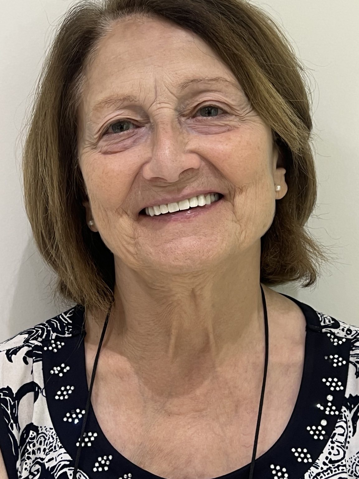 Giovanna dopo il trattamento estetico dentale