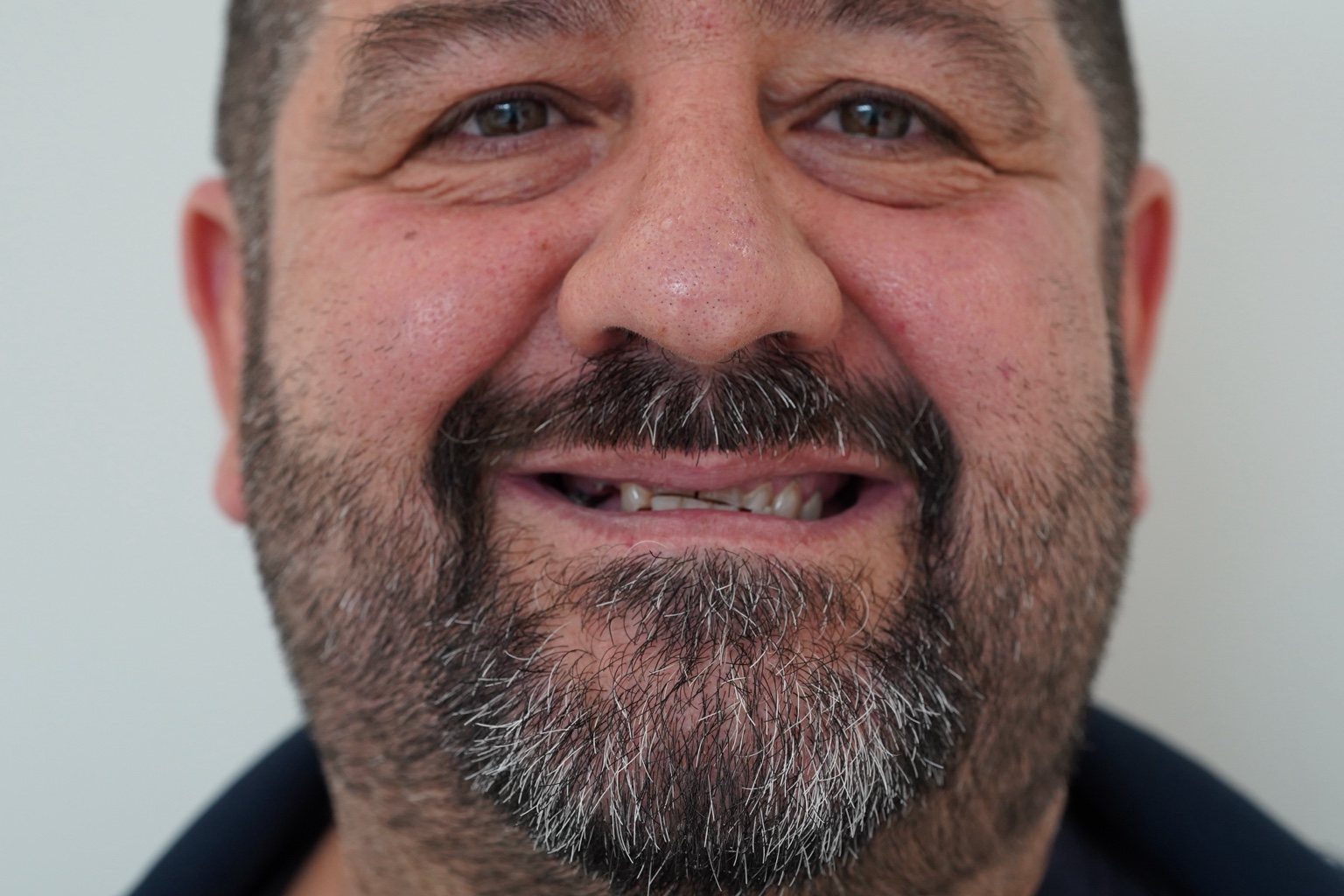 Mario prima del trattamento