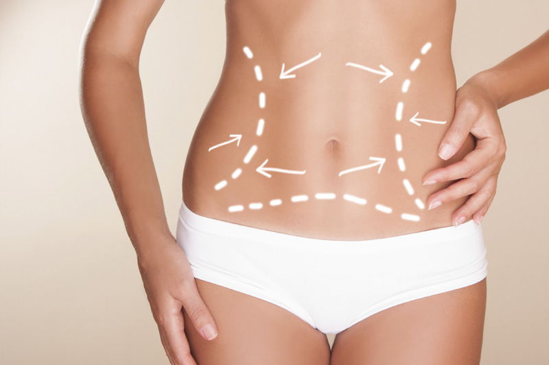 Valutazione per chirurgia del corpo