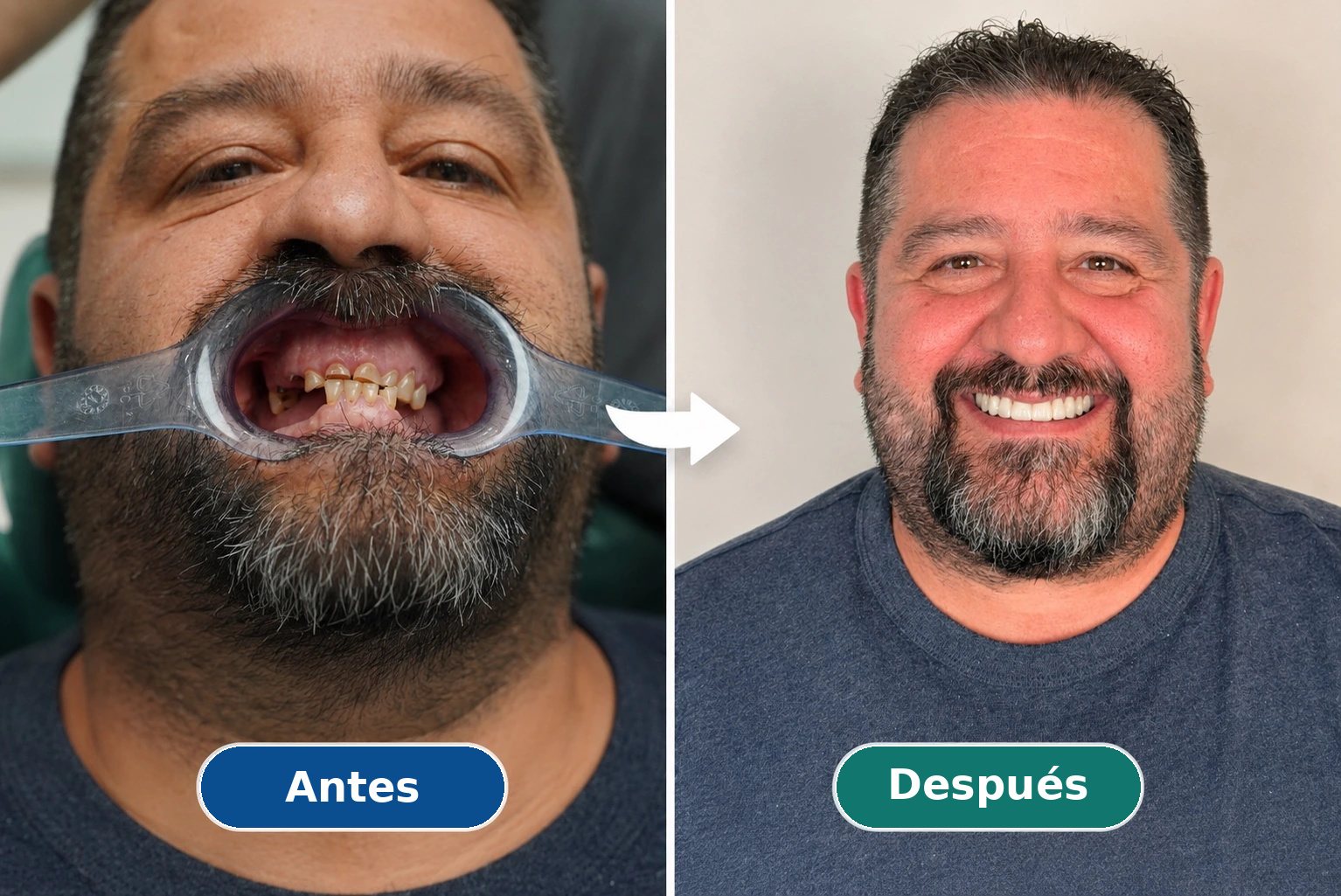 Caso real de rehabilitación dental: antes y después
