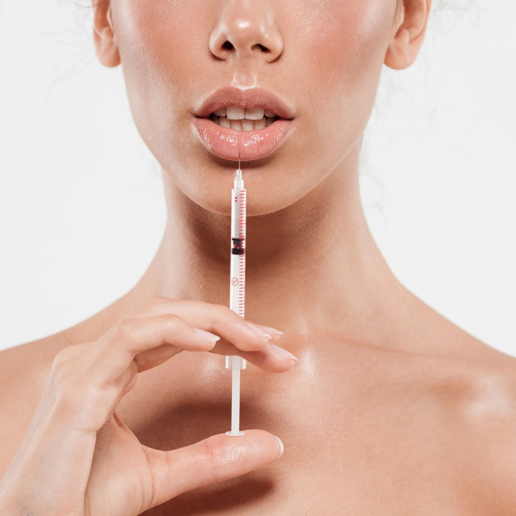 Trattamento filler nella zona delle labbra